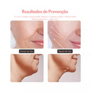 MASSAGEM FACIAL Bivolt  -  Led Aparelho Tratamento Com Luz Bivolt -  (Cores Sortidas)